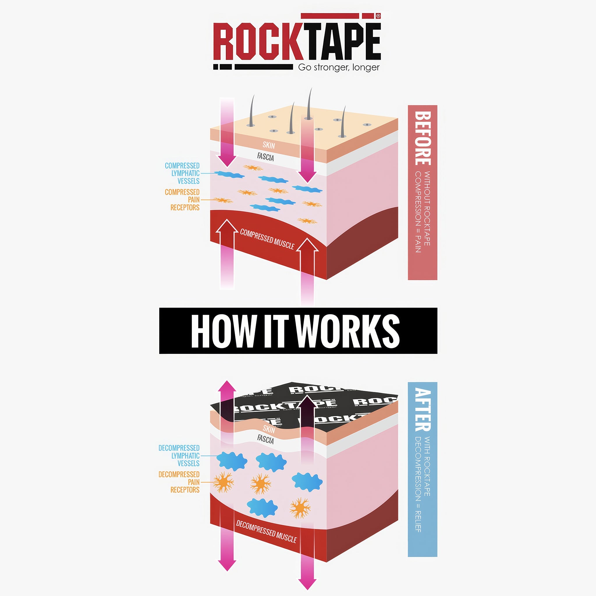 Standart Kinezyoloji Bant | Pembe Kurukafa | 5cm x 5m