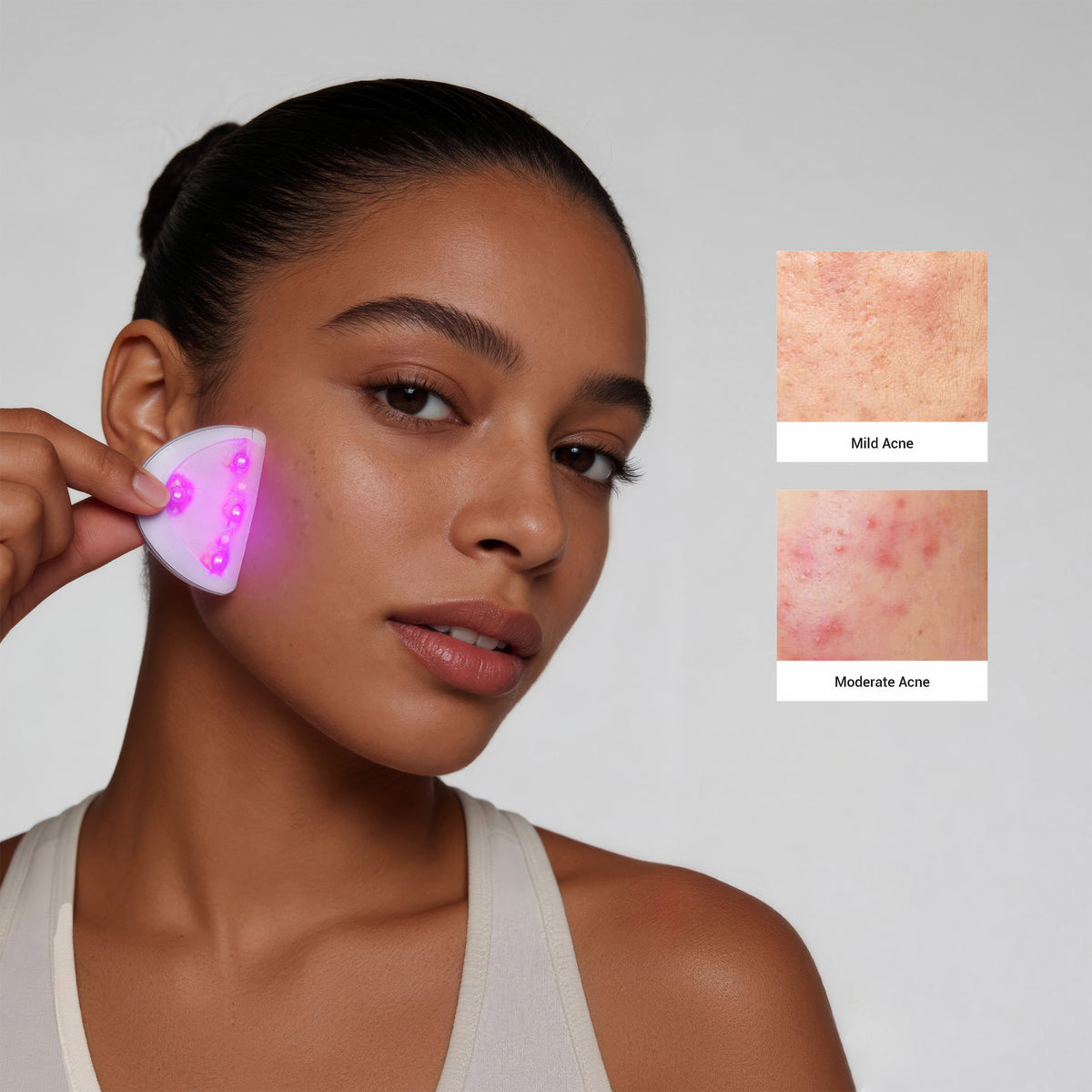 FlexPure LED Acne Patch