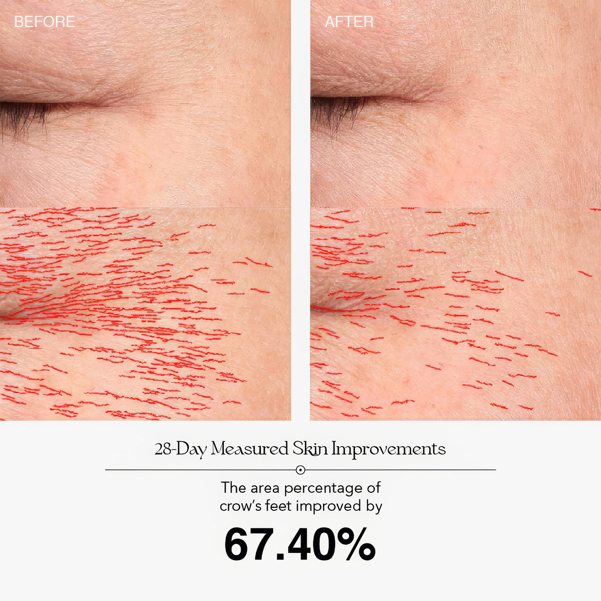 SkinLift Pro LED Cilt Bakım Cihazı